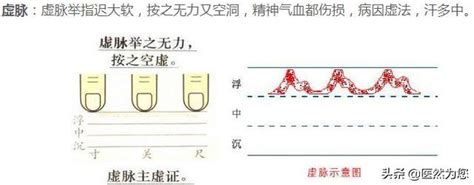 脈細數|脈象動圖解讀虛脈、微脈、細脈、代脈、短脈，普通人。